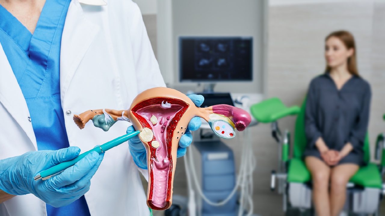 Doctor pointing to fibroids on an anatomical model of the uterus, with a patient seated in the background