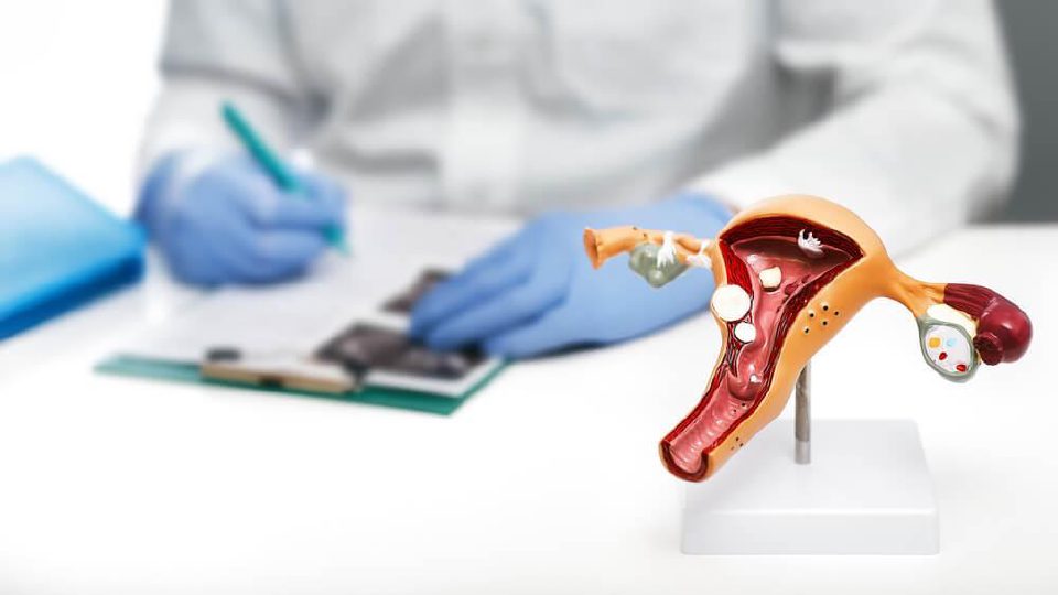 Anatomical model of the uterus on a doctor's desk